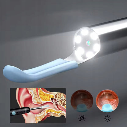Inspection Endoscope Otoscope Ear Cleaning Device Earwax Camera WiFi SMART Zenwire Y24