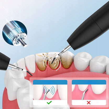 Ultrasonic Dental Scaler Tooth Tartar Removal Dental LED Zenwire J09